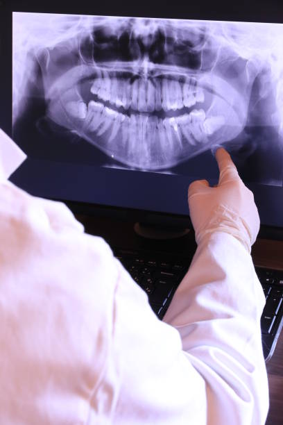 Best Emergency Wisdom Teeth Removal in Hideaway, TX