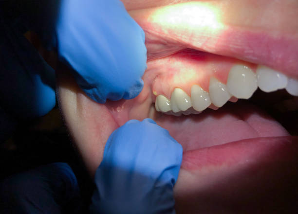Best Urgent Care for Lost Fillings or Crowns in Hideaway, TX
