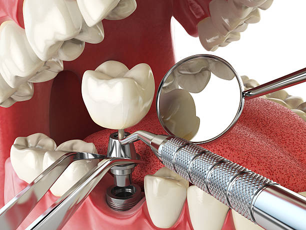 Best Emergency TMJ Treatment in Hideaway, TX
